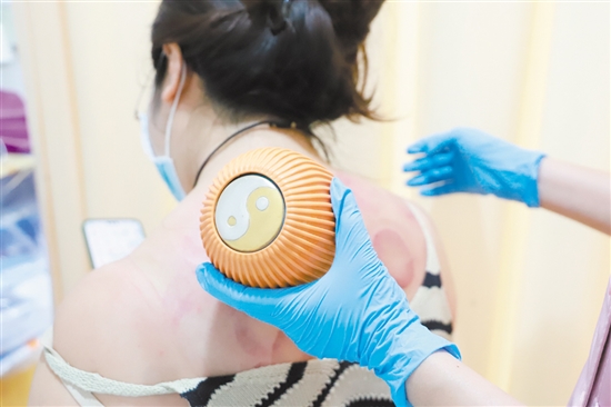 醫(yī)護人員在夜間門診為患者拔火罐。