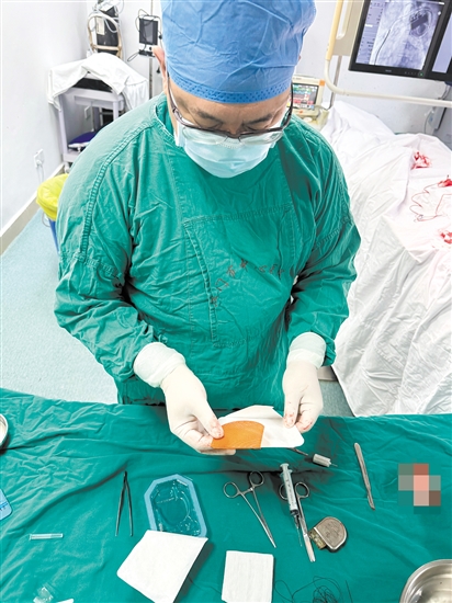 醫(yī)生在準備TYRX可吸收抗菌封套。