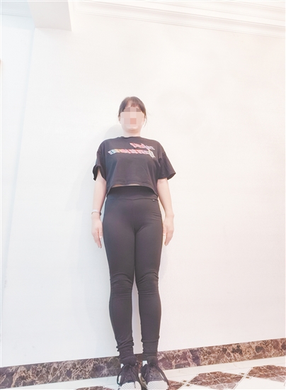 高女士減脂前后對(duì)比。